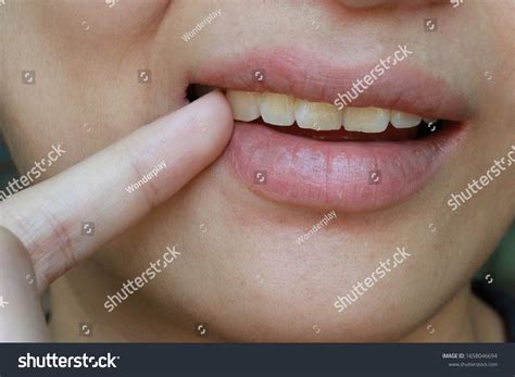 910 Gross Teeth Images, Stock Photos & Vectors | Shutterstock