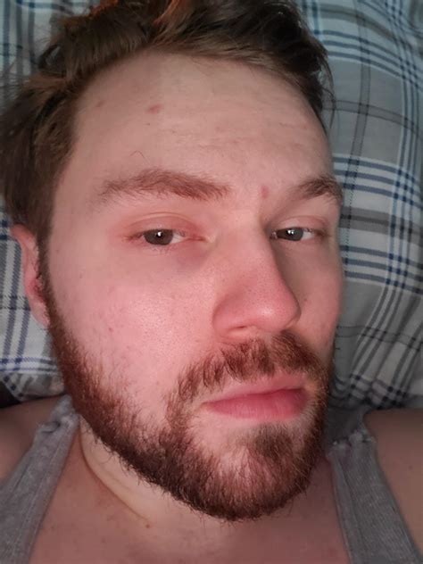 [Skin Concern] Advice for blackheads that wont seem to go away? : r