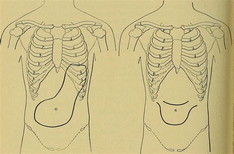 Common symptoms of pyloric stenosis | General center | SteadyHealth.com