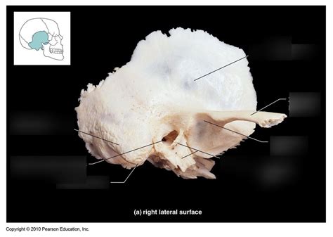 anatomy  physiology chapter  temporal bone diagram quizlet