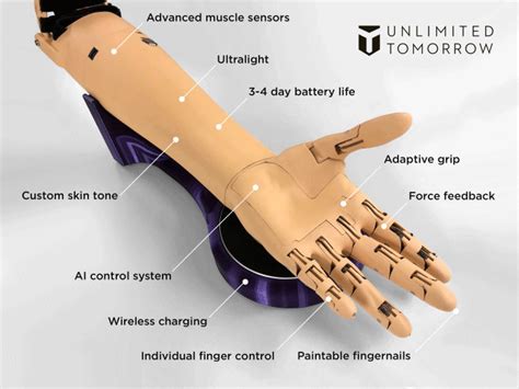 Prosthetic Arm 3d Model