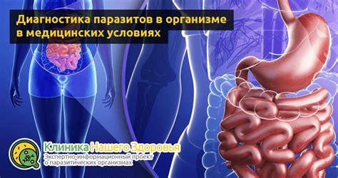 Паразиты в кишечнике человека: симптомы, признаки, лечение