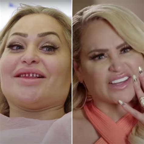Stacey Silva Before and After Veneers: Teeth Photos | In Touch Weekly