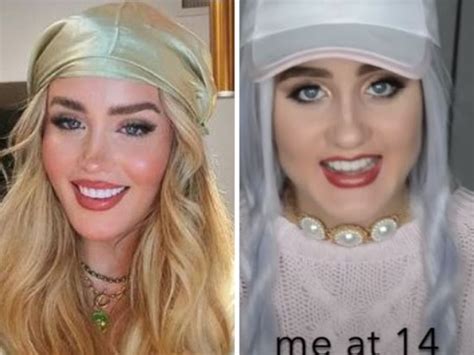 cosmetic surgery latest beauty industry news newscomau
