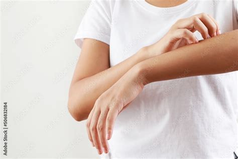 These types of itchy skin rashes can improve and heal. Stock Photo ...