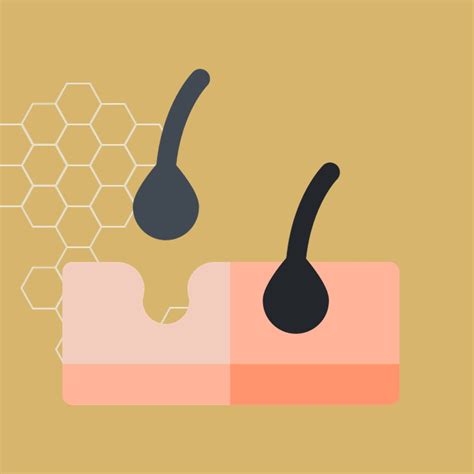 PRP Therapy for Hair Regrowth in Ahmedabad - Dr. Sneha's Skin Solutions