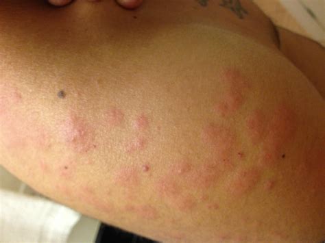 Urgent The Studio 6 Mountlake Terrace Wa Seattle Has A Secret Breakfast Hurry!