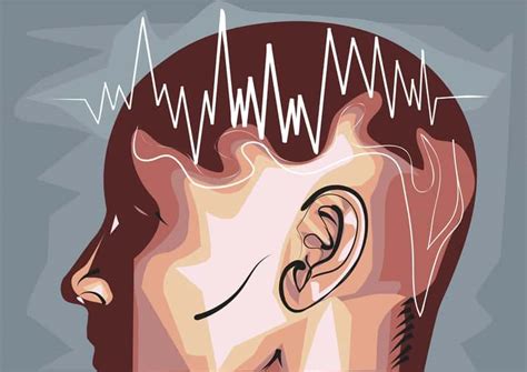 New EEG Insights Offer Window into Hypersomnia Differential Diagnosis ...