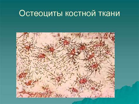 Костная ткань Развитие костной ткани Остеоциты