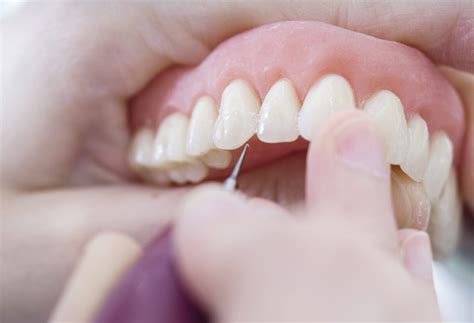 how to whiten dentures at home