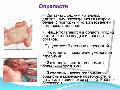 Неинфекционные заболевания кожных покровов - презентация онлайн