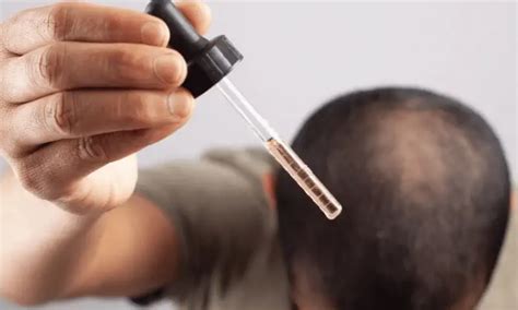 Does Blocking DHT Regrow Hair? Success Rate and Side Effects