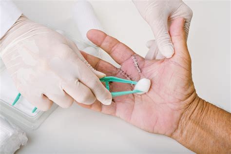 suturing wound care doral urgent care