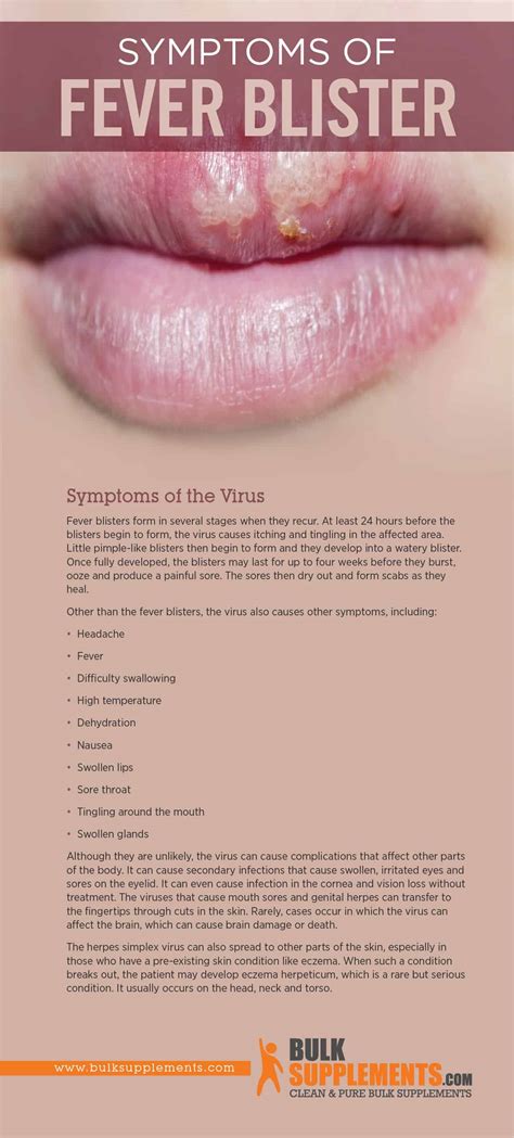 Can A Fever Cause Blisters On Lips - Infoupdate.org