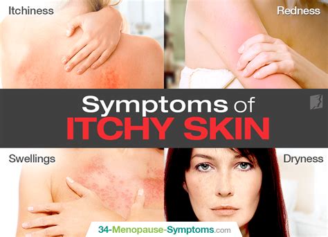 Symptoms of Itchy Skin