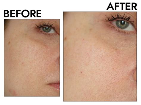 The 10 Best Pore Minimizers of 2025, Tested and Reviewed