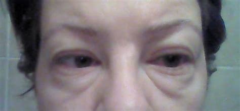 Dear Skin: ALERGIJE NA KOZMETIKU