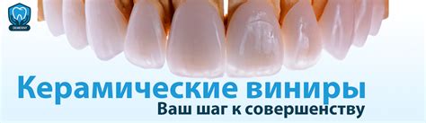 Керамические виниры, цены на виниры в Молдове
