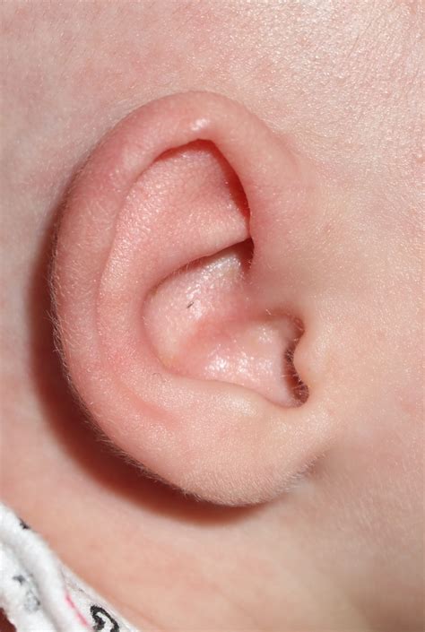 ear deformity correction uva facial plastic surgery