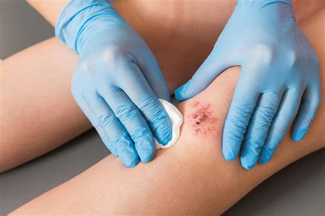 modern wound care wecare clinic