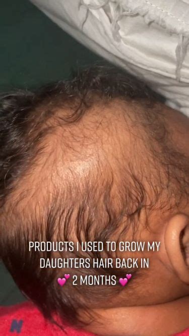 how to help baby hair grow