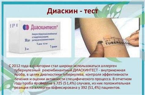 Диаскинтест положительный результат фото – Положительный результат ...