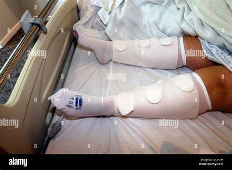 Why Wear Stockings In Hospital at Eva Byrne blog