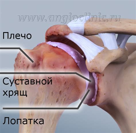Артроз плечевого сустава (плечелопаточный периартрит) - диагностика и ...