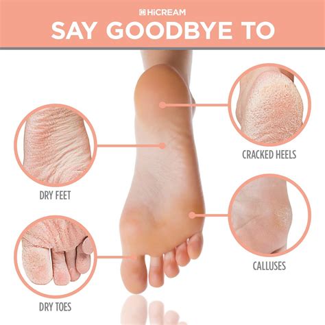 Foot Peel Mask for Cracked Heels & Calluses - Exfoliating Treatment to