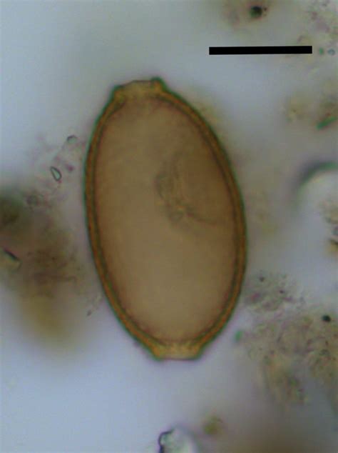 Capillariid egg [IMAGE] | EurekAlert! Science News Releases