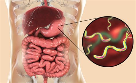 Helicobacter Pylori: Effective Treatment Strategies Unveiled