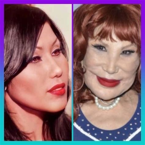 Lyn May Antes Y Después: A Deep Dive Into The Life And Transformation ...