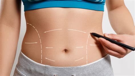 how much to get liposuction