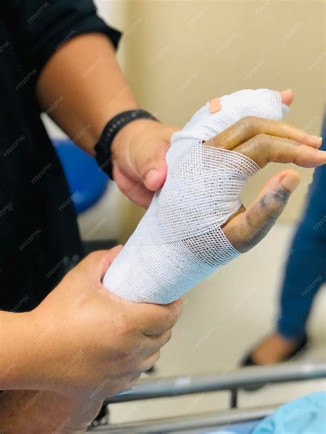 how to tell if a finger is broken 4