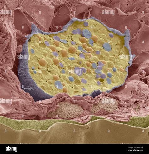 Frog pigment cell. Coloured scanning electron micrograph (SEM) of a ...
