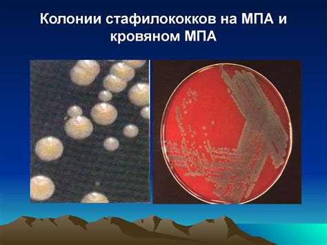 Стафилококки. Стрептококки. Менингококки. Гонококки - презентация онлайн