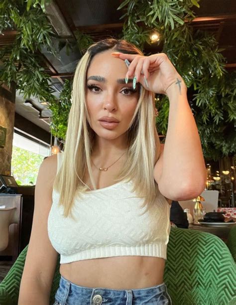 Manelyk González casi se queda ciega por un pésimo tratamiento estético