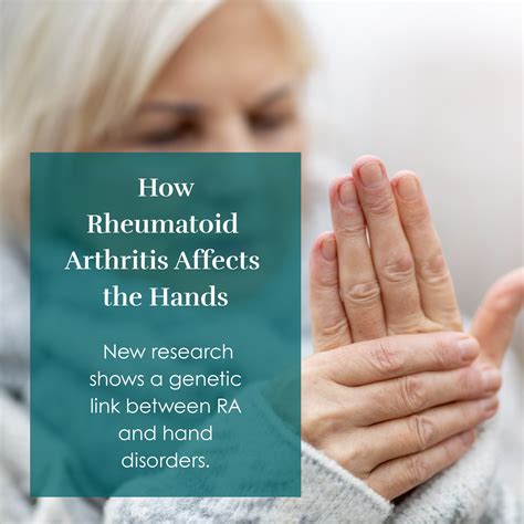 rheumatology associates charleston sc 5