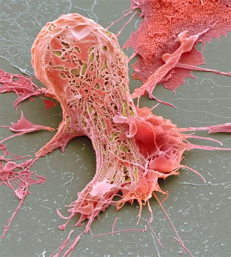 Cancer Cell Death – Science Photo Library