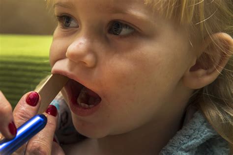 Eruzioni cutanee improvvise nei bambini - Nostrofiglio.it