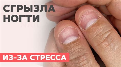 Наращивание на ОБГРЫЗЕННЫЕ ногти | Как исправить? - YouTube