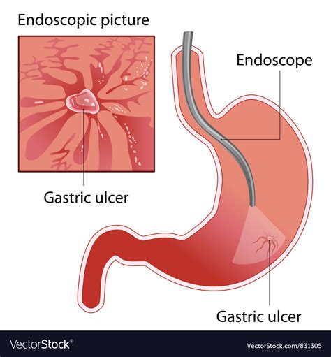 Endoskop Royalty Free Vector Image - VectorStock