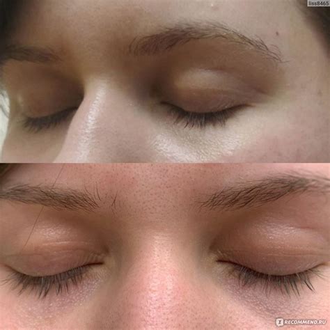 Сыворотка для ресниц Careprost Eyelash Serum - «Безопасный состав и ...