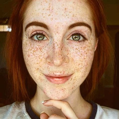 Pin on Freckles!