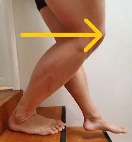 VMO Activation Exercises for Knee Stability and Performance