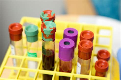 Understanding Sex Hormone Binding Globulin (SHBG) - Healor