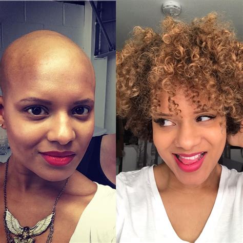 before and after chemo cream face 5