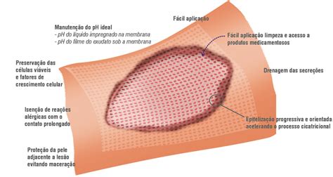 Ferida Com Tecido De Granulação E Fibrina - Fibrina na Ferida: O que é e Cuidados na Cicatrização - Vuelo Pharma