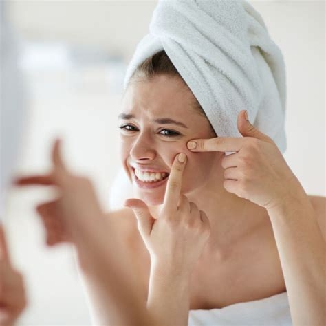 Does your child have teenage acne? (Causes & home remedies)