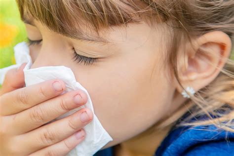 Six Surprising Truths About Kids & Allergies | NYU Langone News